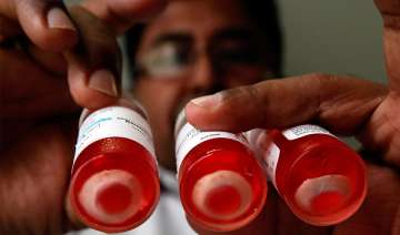 sri lanka donates eyes to the world - India TV sri lanka donates eyes to the world - India TV