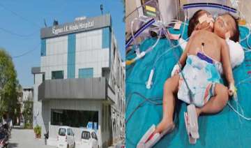 amazing conjoined twins in haryana have a single... amazing conjoined twins in haryana have a single...