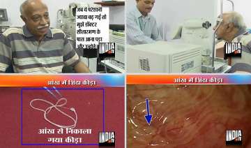 believe it or not 15 cm live worm pulled out of... believe it or not 15 cm live worm pulled out of...