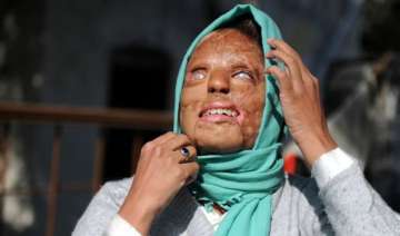 acid attacks what india should learn from... acid attacks what india should learn from...
