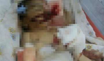newborn dies after being bitten by rats in andhra... newborn dies after being bitten by rats in andhra...