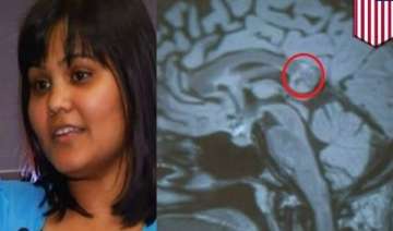 hyderabad woman s brain tumour turns out to be... hyderabad woman s brain tumour turns out to be...