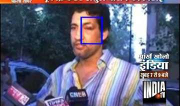 minister s bodyguards assault atul wassan - India... minister s bodyguards assault atul wassan - India...