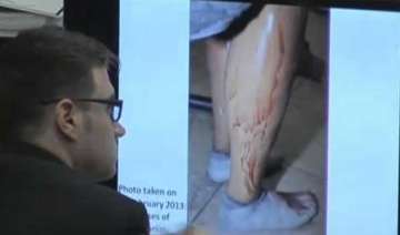 pistorius photographed in bloodied prosthetics -... pistorius photographed in bloodied prosthetics -...