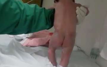 ‘Miracle Baby’ starts walking as soon as he’s born ‘Miracle Baby’ starts walking as soon as he’s born