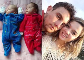 brain dead brazillian woman kept alive for 123 day brain dead brazillian woman kept alive for 123 day