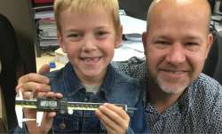 9-year-old Canada boy holds Guinness World Record for longest milk tooth extracted